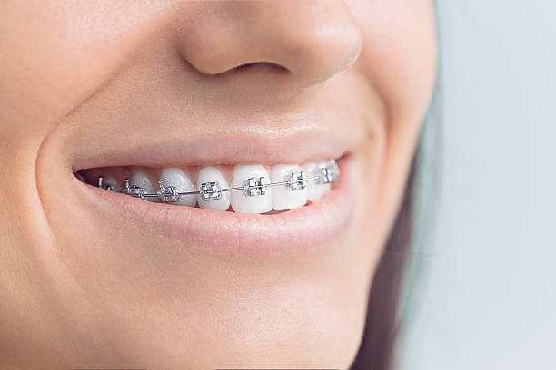 Best Wisdom Tooth Removal  in Reserve, LA